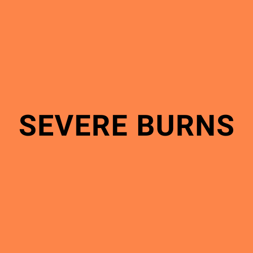 Image showing the words "Severe Burns".